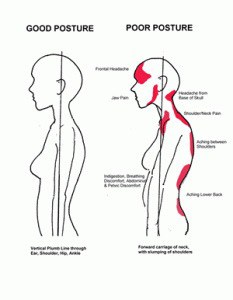 The Surprising Connection Between Posture and Chronic Pain